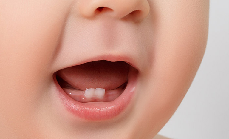 Bài tập cơ miệng cho trẻ chậm nói Bài tập cơ miệng cho trẻ chậm nói