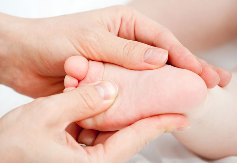 Các tật về phát triển vận động ở trẻ Các tật về phát triển vận động ở trẻ