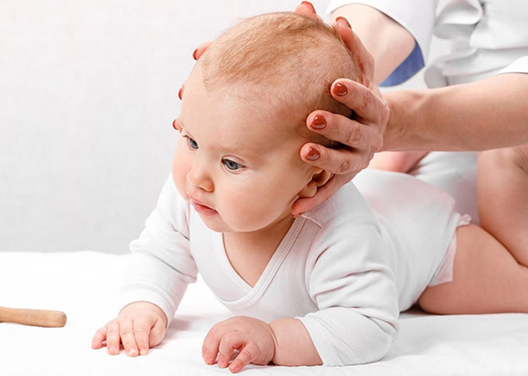 Các tật về phát triển vận động ở trẻ Các tật về phát triển vận động ở trẻ