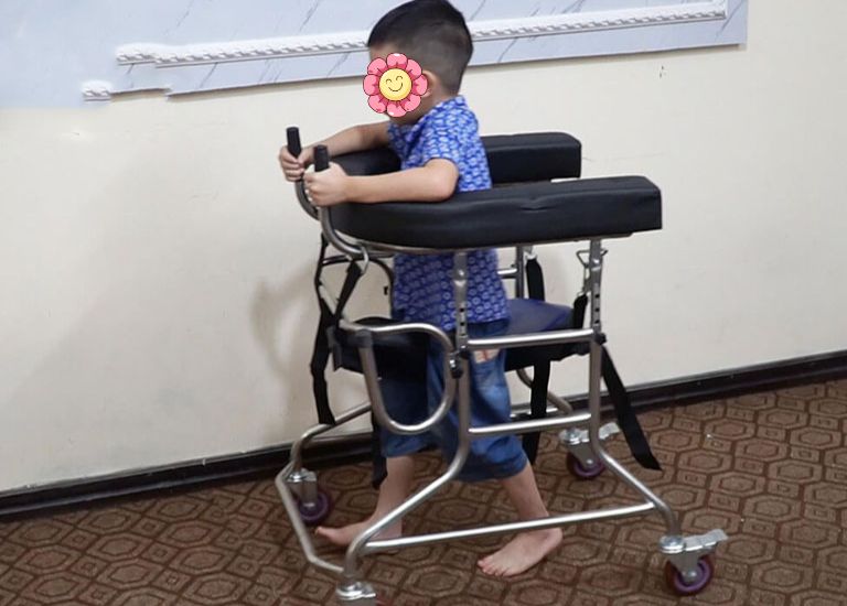 Trẻ đi nhón chân và chậm nói Trẻ bại não không chỉ chậm nói mà con đi nhón chân, không vững vàng cần sự hỗ trợ từ khung tập đi