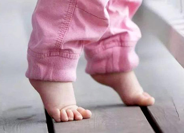 Trẻ đi nhón chân và chậm nói Trẻ đi nhón chân và chậm nói